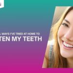 dentist teeth whitening in Wimbledon