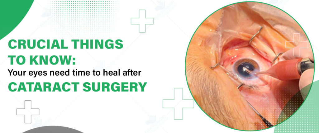Cataract-Surgery