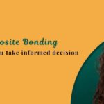 Best composite bonding service in london
