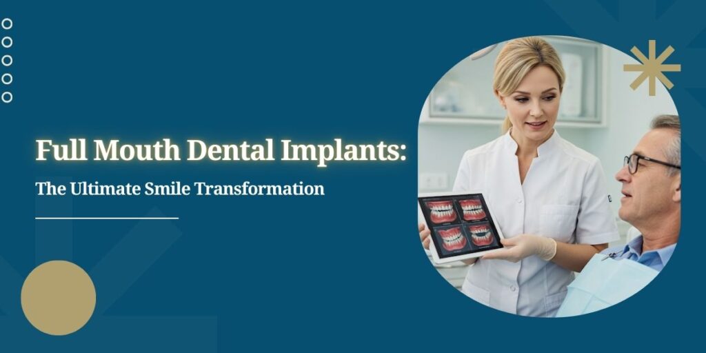 Full mouth dental implants in London