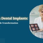 Full mouth dental implants in London