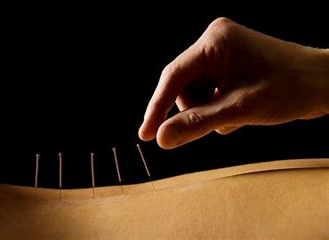 acupuncture for fertility