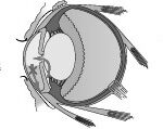 Development of Glaucoma