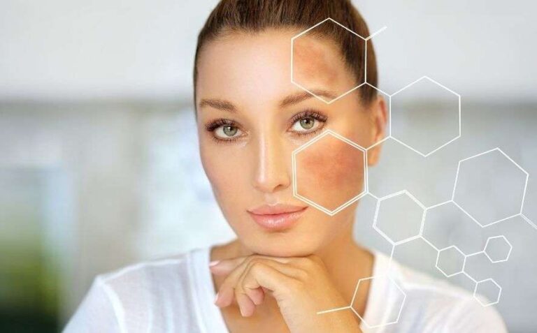 Does Every Skin Type Suit Whitening Treatment?