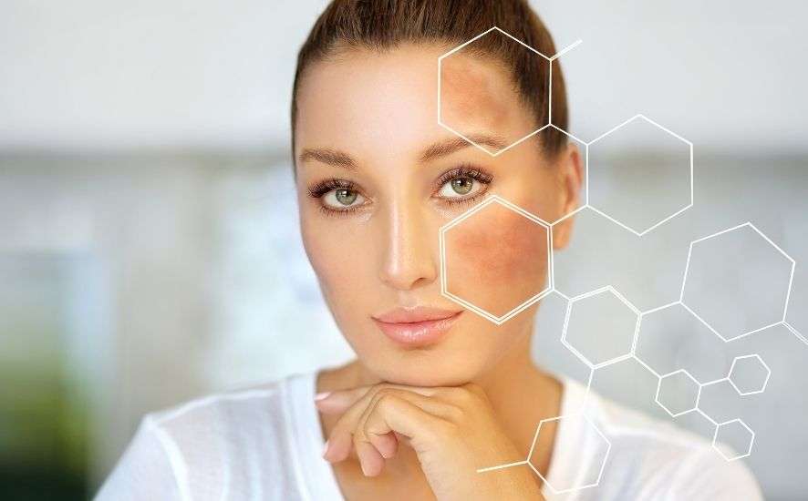 Does Every Skin Type Suit Whitening Treatment?