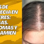 tipos de alopecia en mujeres