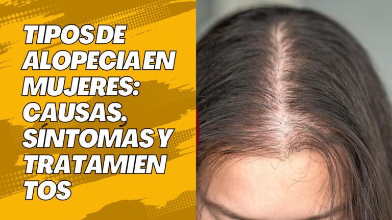 tipos de alopecia en mujeres