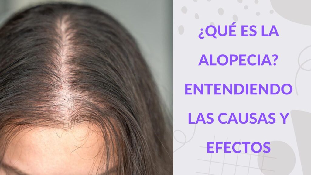 alopecia que es