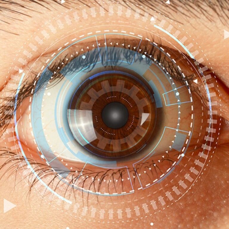 eye