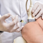 Is PRP Treatment Effective for Tennis Elbow?