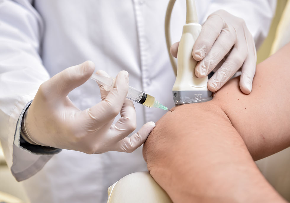 Is PRP Treatment Effective for Tennis Elbow?