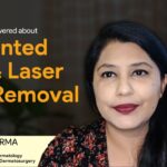 laser hair removal