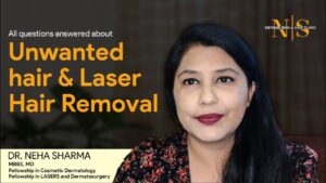 laser hair removal