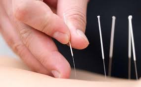acupuncture for sports performance