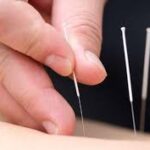 acupuncture for sports performance