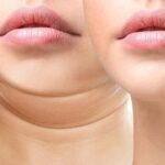 how to get rid of double chin overnight