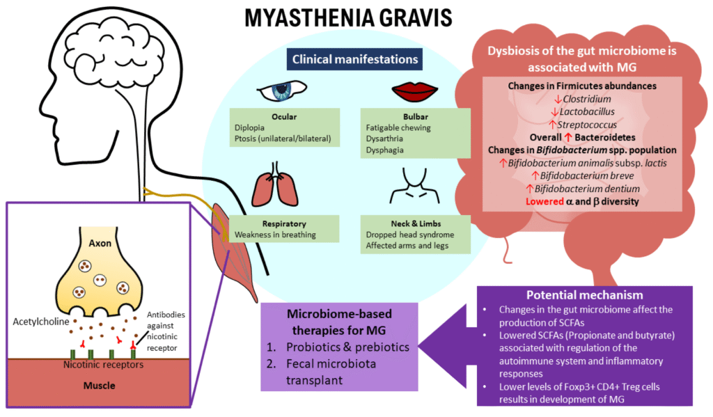 Boost Your Wellbeing Naturally with These Myasthenia Gravis Remedies