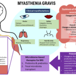 Boost Your Wellbeing Naturally with These Myasthenia Gravis Remedies