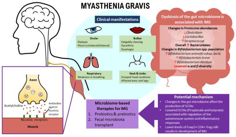 Boost Your Wellbeing Naturally with These Myasthenia Gravis Remedies