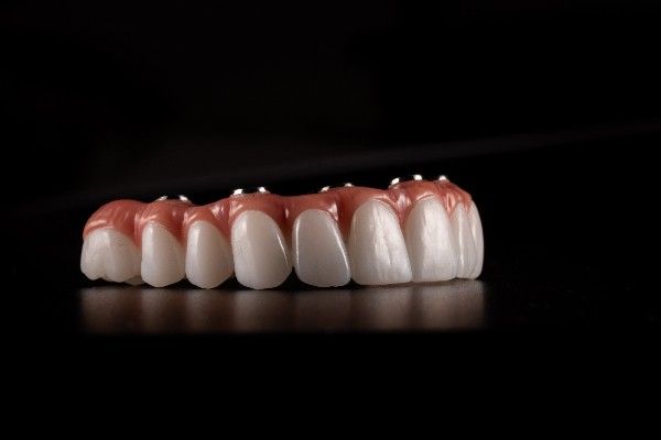 Smilo Dental Implants