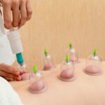 silicone cupping set