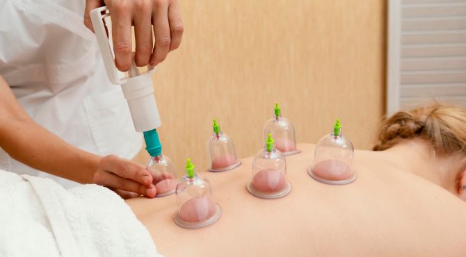 silicone cupping set