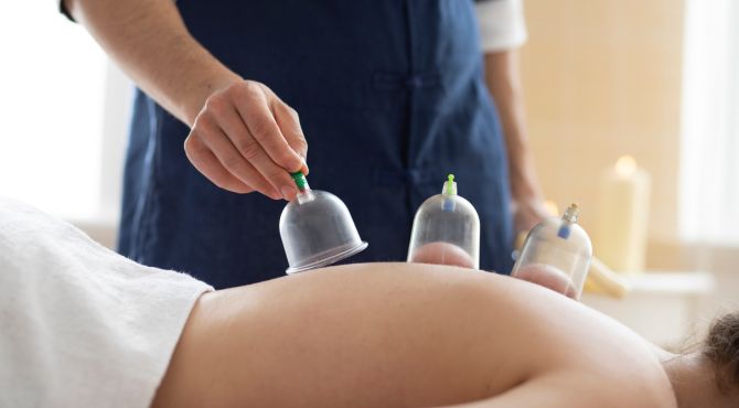silicone cupping set
