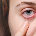 glaucoma treatment