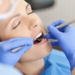 Dental Implant