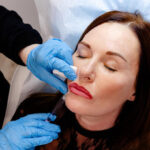 Botox Delray Beach