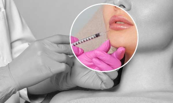 Lipfiller