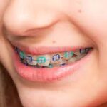 Orthodontist for Children