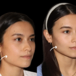 Best Plastic Surgeon in dubai