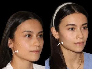 Best Plastic Surgeon in dubai