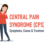 central pain syndrome causes
