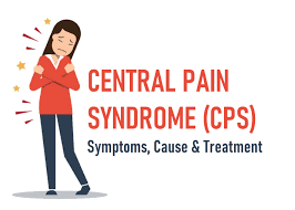 central pain syndrome causes