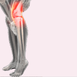 Best Knee Replacement Surgeon in Jaipur