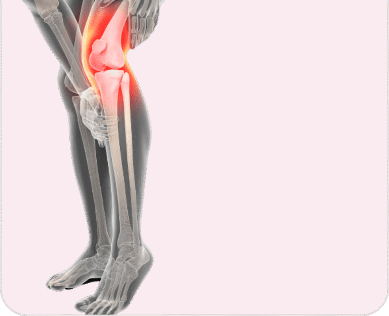 Best Knee Replacement Surgeon in Jaipur