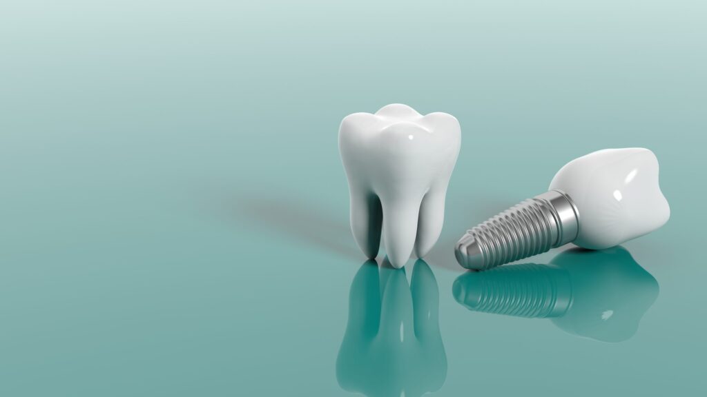Dental Implants Hampshire