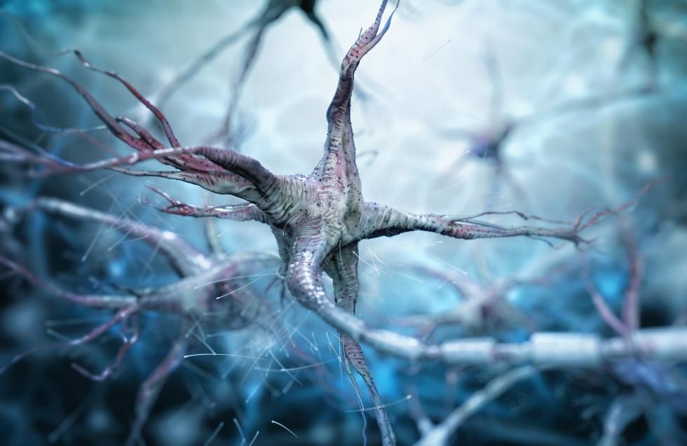 Alzheimer’s