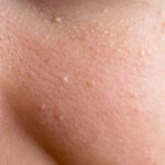 Best home products for large pore treatment