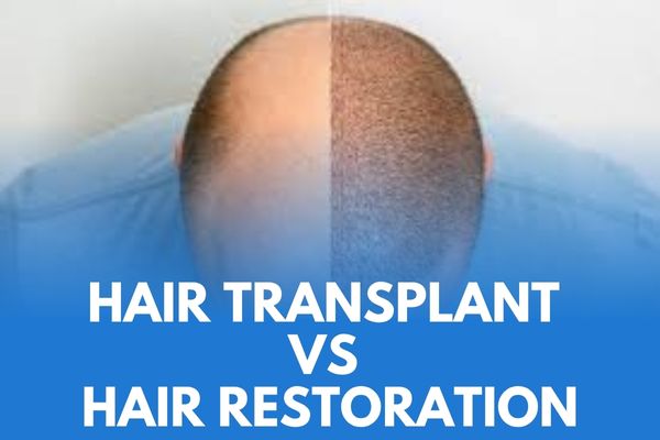 Hair transplant vs hair restoration