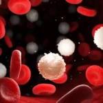 high cholesterolemia Dubai