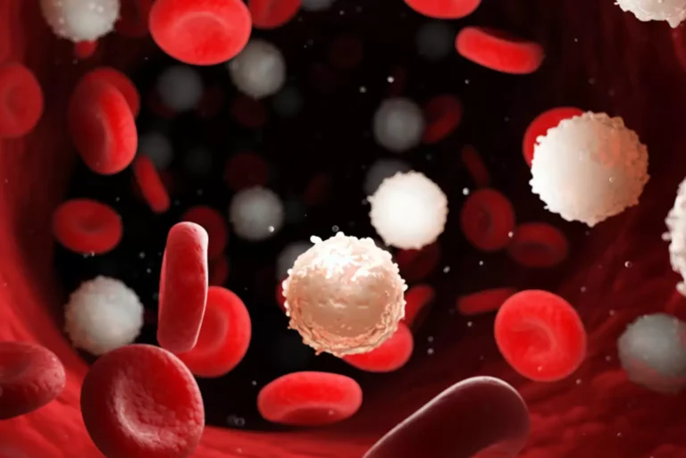 high cholesterolemia Dubai