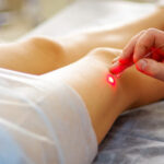 Scar Laser Treatment Restore Skin Appearance