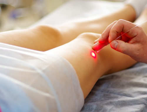 Scar Laser Treatment Restore Skin Appearance