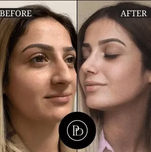 Where to Find the Best Plastic Surgeon in Dubai – My Insider