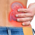 Kidney