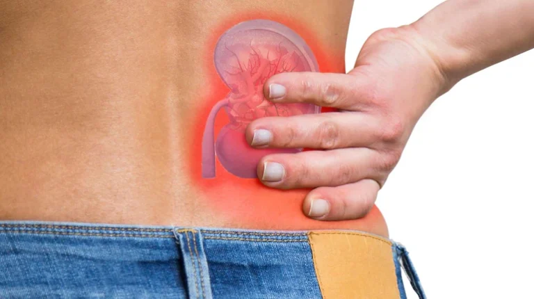 Kidney