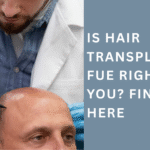 hair transplant fue